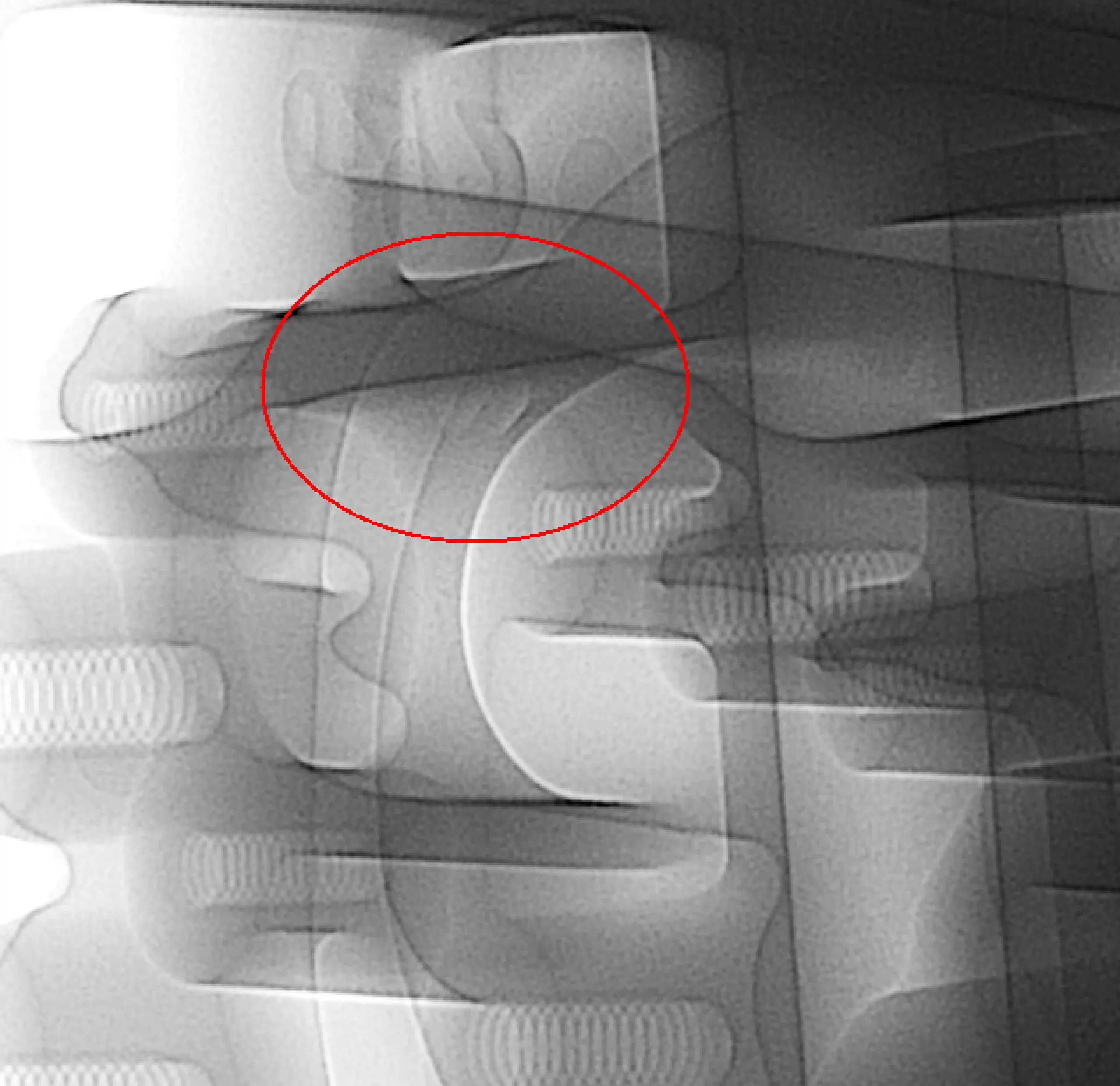 2D Computertomographie eines Motorblocks