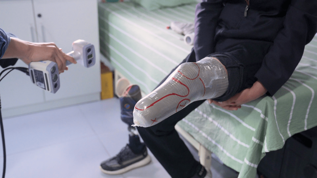 Shining 3D EinScan H2 prosthesis 3D scan